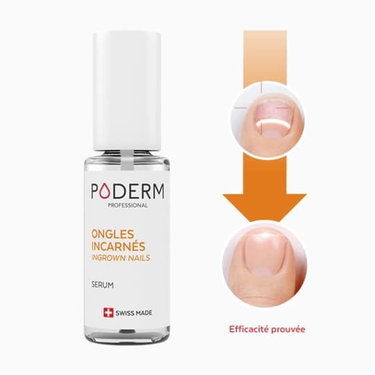 PODERM ONGLE INCARNE APAISANT 8ML — Pharmacie Pharmagreen Boucicaut